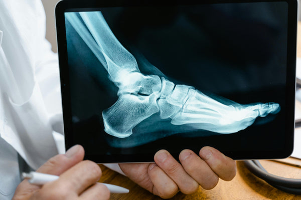 Small Changes That Prevent Big Office Injuries